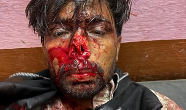 सांकड़ा क्षेत्र में युवक का नाक काट मौके से फरार हुए बदमाश